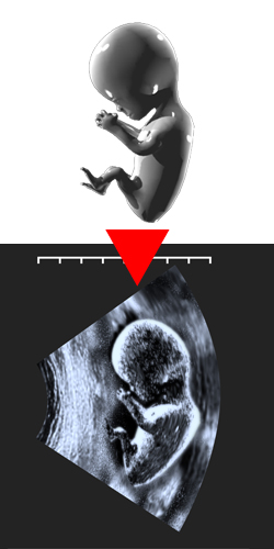 エコー写真風の胎児ＣＧイラスト